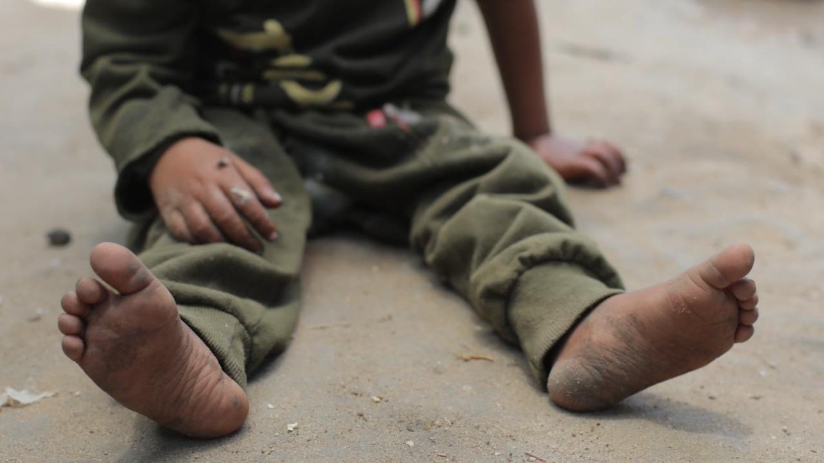 🔴 Gazze'de kıtlık sebebiyle en az 40 çocuk hayatını kaybetti.