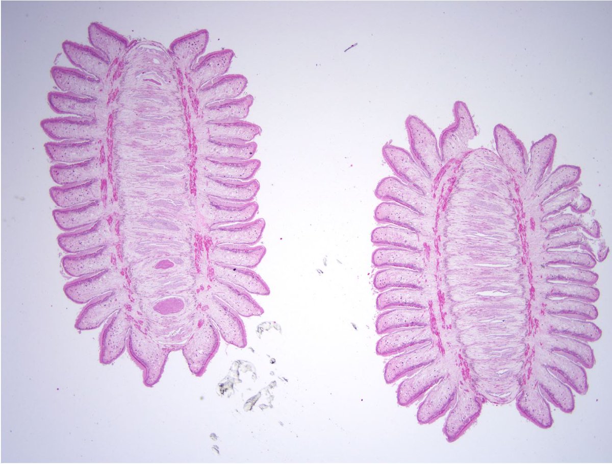ParasiteGal's tweet photo. #Parasite case 750 is up – passed per rectum in a child from Ethiopia. What is your diagnosis? https://t.co/CEijYtiTHQ  #mayopath #pathology #CrittersOnTwitter #PathBugs https://t.co/9IMah4vJkr