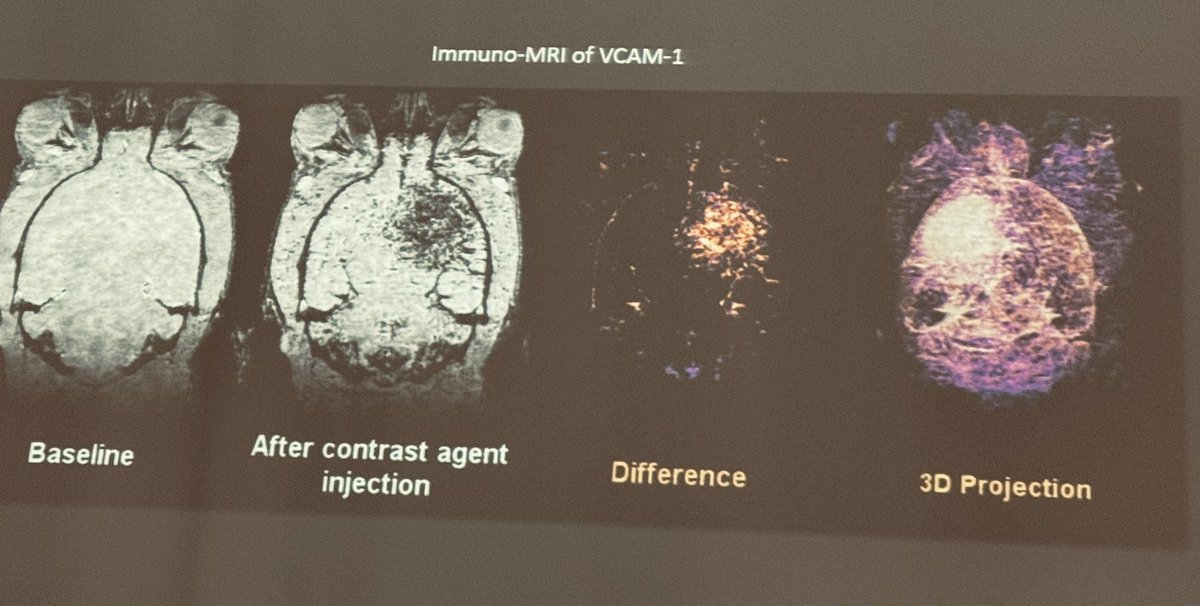 Sara Martinez de Liz (@s_martinezdeliz) on Twitter photo ...& last but not least <a href="/Gauberti_M/">Maxime Gauberti</a> presented in the last session our immuno-MRI and MPI methodology using sub-micrometric biodegradable probes and its potential to clinical translation. Hope he pleased the crowd ⚫️🧠🫀🫁🌌 #TheFutureofMolecularMR ...& last but not least <a href="/Gauberti_M/">Maxime Gauberti</a> presented in the last session our immuno-MRI and MPI methodology using sub-micrometric biodegradable probes and its potential to clinical translation. Hope he pleased the crowd ⚫️🧠🫀🫁🌌 #TheFutureofMolecularMR