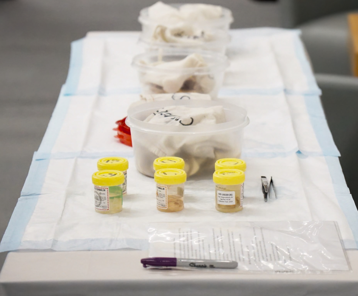 Bruce McManus Cardiovascular Biobank (@hli_bmcb) on Twitter photo On June 7, #BMCB hosted a fun Hands-on-Hearts workshop at the 2024 St Paul's Heart Centre Education Day π«π©Ί Our team had a blast sharing insights about the #HeartBiobank, showcasing #HCM, #DCM, #CAD, #amyloidosis hearts. Big thanks to all who joined us!
π·: <a href="/tiffanyejc/">Tiffany E. Chang</a> On June 7, #BMCB hosted a fun Hands-on-Hearts workshop at the 2024 St Paul's Heart Centre Education Day π«π©Ί Our team had a blast sharing insights about the #HeartBiobank, showcasing #HCM, #DCM, #CAD, #amyloidosis hearts. Big thanks to all who joined us!
π·: <a href="/tiffanyejc/">Tiffany E. Chang</a>