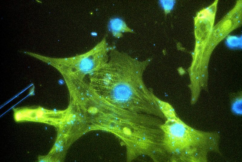 jmarieali's tweet photo. #Fluorescence #micro #HeartCells https://t.co/o39QOPqD1w
