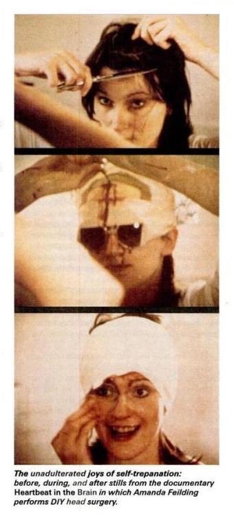 ACSHorg's tweet photo. @jonathanstea @jonathanstea I wouldn’t be surprised if these pseudoscientific alternative treatment grifters next propose a DIY Trepanning revival #NotaGoodIdea 

https://t.co/6E8AwdPTxS https://t.co/q8SRjJv9wk