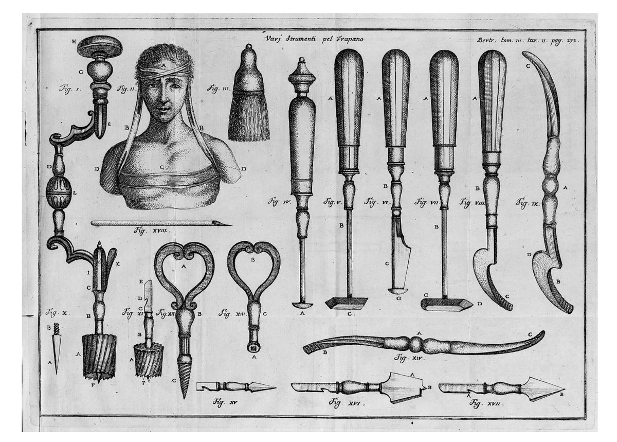 ACSHorg's tweet photo. @jonathanstea @jonathanstea I wouldn’t be surprised if these pseudoscientific alternative treatment grifters next propose a DIY Trepanning revival #NotaGoodIdea 

https://t.co/6E8AwdPTxS https://t.co/q8SRjJv9wk