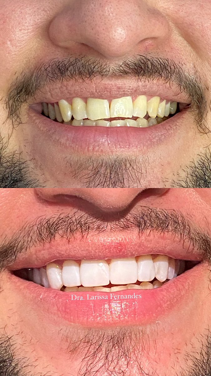 larixff's tweet photo. Meu trabalho é muito lindo pra ficar só na galeria🤤
CRORJ 55922 https://t.co/gvWjYa1Ca4