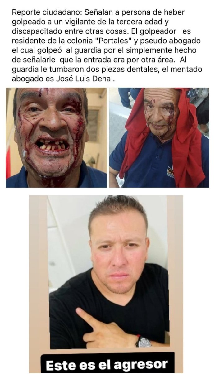 NEUROSURGEONNN's tweet photo. HÁZLO VIRAL VIRAL VIRAL:

Ha SIDO DETENIDO el ABOGADO que golpeó al GUARDIA de SEGURIDAD de 72 años de edad quién perdió 2 de sus dientes durante la salvaje AGRESIÓN FÍSICA a GOLPES.

#REPOSTEAME_Y_TE_REPOSTEO 

Michoacán https://t.co/qUrz6O3NO2