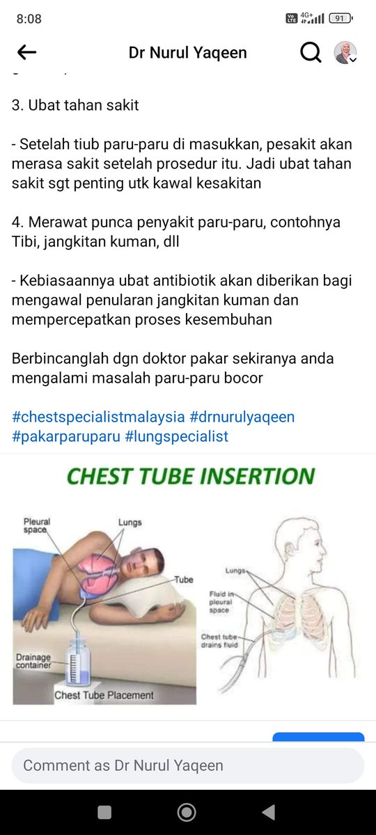 4 RAWATAN PARU-PARU BOCOR YG TAK RAMAI ORG TAHU