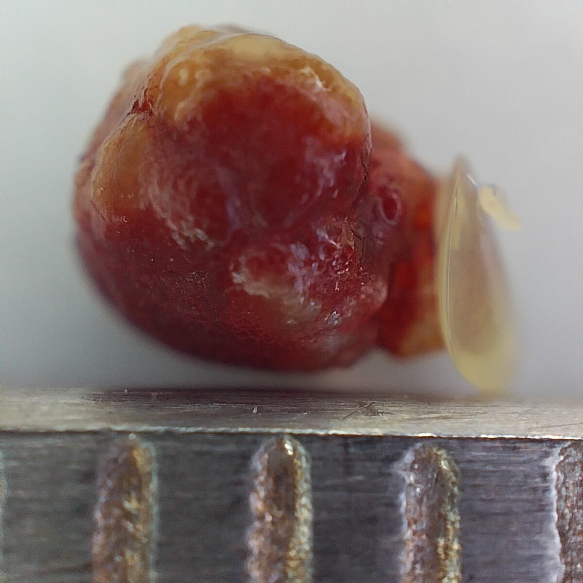 DrCesarMayorga's tweet photo. Another little monster removed from a ureter. Previous ureteral bypass got kinked and we decided to fix the catheter and removed the stone causing the primary problem. I wonder what is the mineral composition of the two structures united into one stone. #nefrovetcolombia https://t.co/nNsoJemMEQ