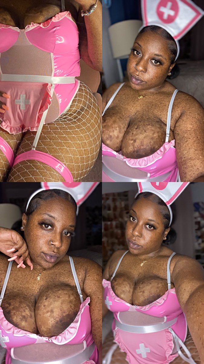 daisha_085's tweet photo. Need a nurse👀👩🏾‍⚕️🩷 https://t.co/9B3kCoqS7l