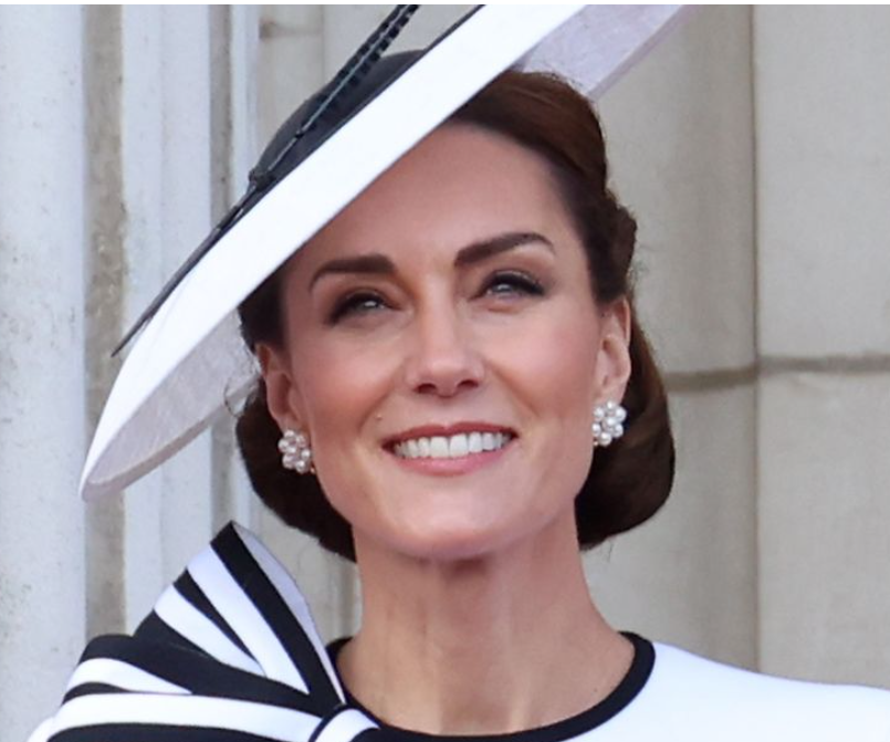 sallie6youtube's tweet photo. I don't know if Kate has had any work done? I believe it's a good thing for us woman & men to look our best this day & age.
People are saying Kate has had work done!
New veneers & nose?
& she may have had a little nip & tuck with visible bruises while off 'work'?
#KateIsBack https://t.co/3bBRm1vnUj