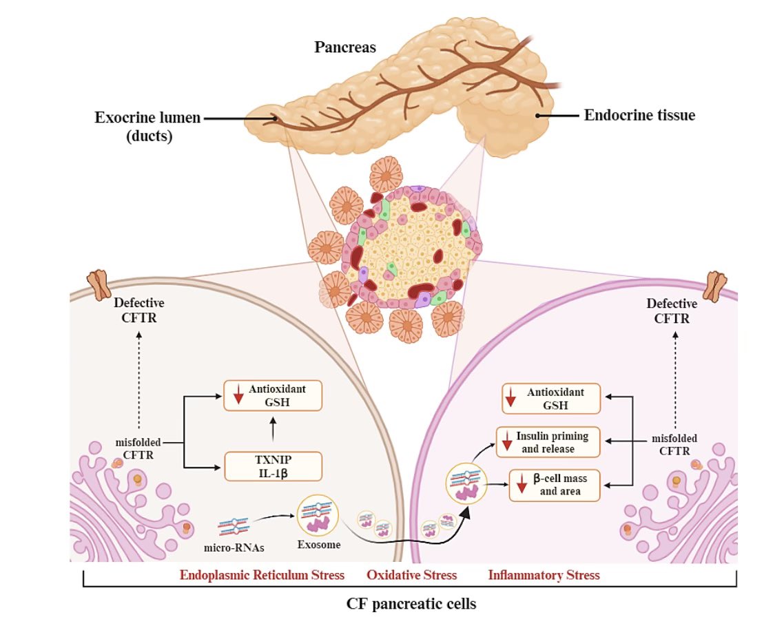 Dr Shafa Waters (@shafawaters) on Twitter photo Check out our new pub exploring mechanisms of #Cystic Fibrosis Related #Diabetes (#CFRD) pathogenesis n novel therapeutic options, which addresses priorities selected by #CF community members w <a href="/_balancinglife/">Bala</a> <a href="/nucDIABETES/">James Shaw</a> <a href="/KiWookKim816/">Ki Wook Kim 김기욱</a> <a href="/KeithCYOoi/">Dr Keith Chee Y. Ooi</a> <a href="/UNSWMedicine/">UNSW Medicine & Health</a> <a href="/cftrust/">Cystic Fibrosis Trust</a> Check out our new pub exploring mechanisms of #Cystic Fibrosis Related #Diabetes (#CFRD) pathogenesis n novel therapeutic options, which addresses priorities selected by #CF community members w <a href="/_balancinglife/">Bala</a> <a href="/nucDIABETES/">James Shaw</a> <a href="/KiWookKim816/">Ki Wook Kim 김기욱</a> <a href="/KeithCYOoi/">Dr Keith Chee Y. Ooi</a> <a href="/UNSWMedicine/">UNSW Medicine & Health</a> <a href="/cftrust/">Cystic Fibrosis Trust</a>