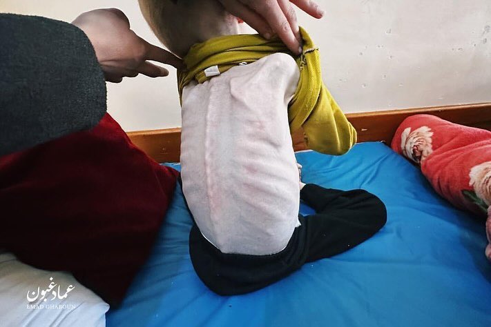 أمهات شهدوا وفاة أطفالهم لأنهم لم يستطيعوا تأمين ما يبقيهم على قيد الحياة

مستمرين على الهاشتاق 👇🏻

#شمال_غزة_يموت_جوعاً
"#Famine_in_North_Gaza"