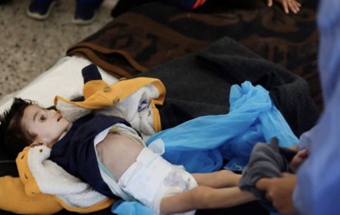 #Famine_in_North_Gaza
#شمال_غزة_يموت_جوعاً