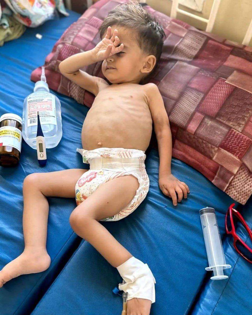 #Famine_in_North_Gaza
#شمال_غزة_يموت_جوعاً