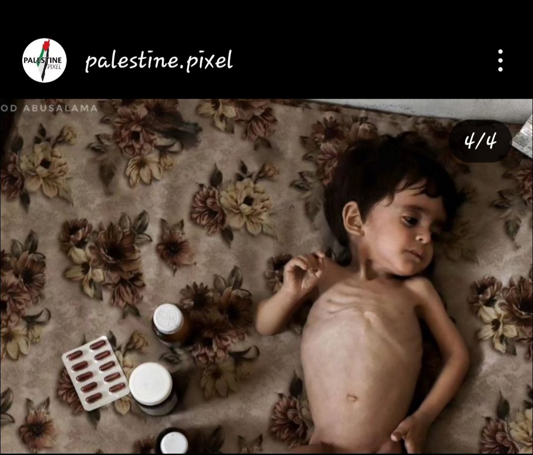 #Famine_in_North_Gaza
#شمال_غزة_يموت_جوعاً