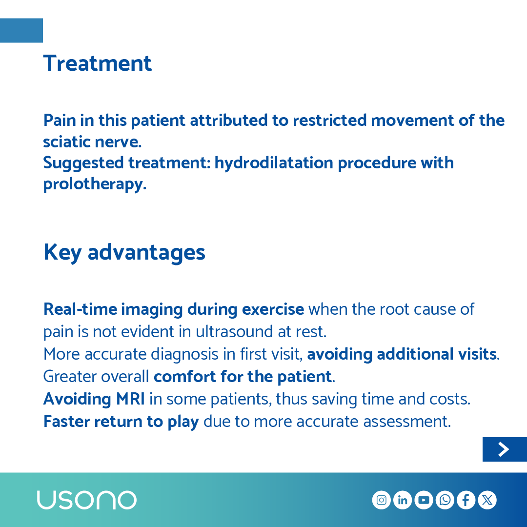 Great clinical case by Prof Fernando Jiménez Díaz <a href="/fjdconesa/">Dr. Fernando Jimenez</a> explaining the diagnosis of persistent sciatic pain with dynamic ultrasound images. 🔗bit.ly/sciatic-dynami… #mskus #mskrad #dynamicultrasound