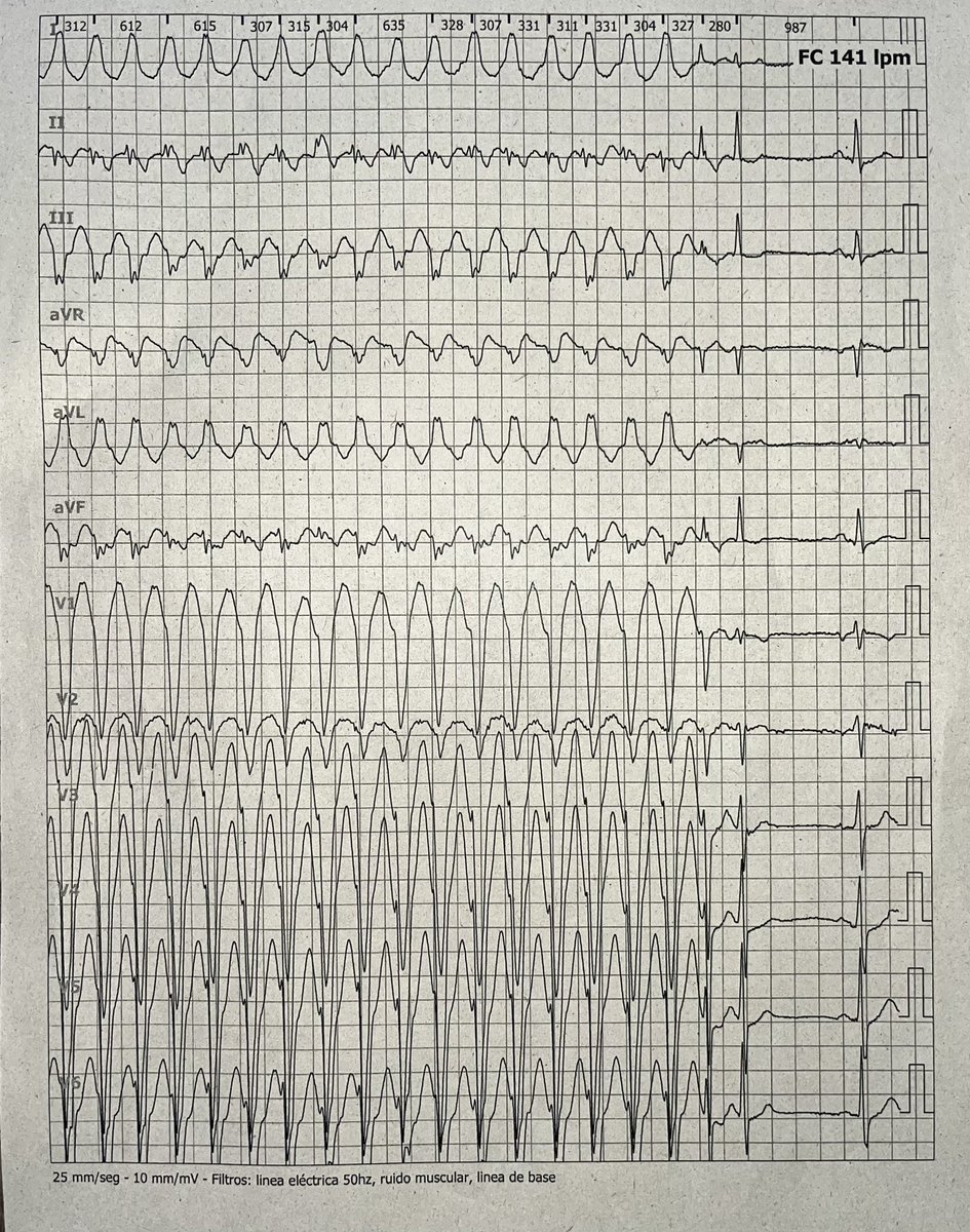 ALBERTO ALFIE tweet media