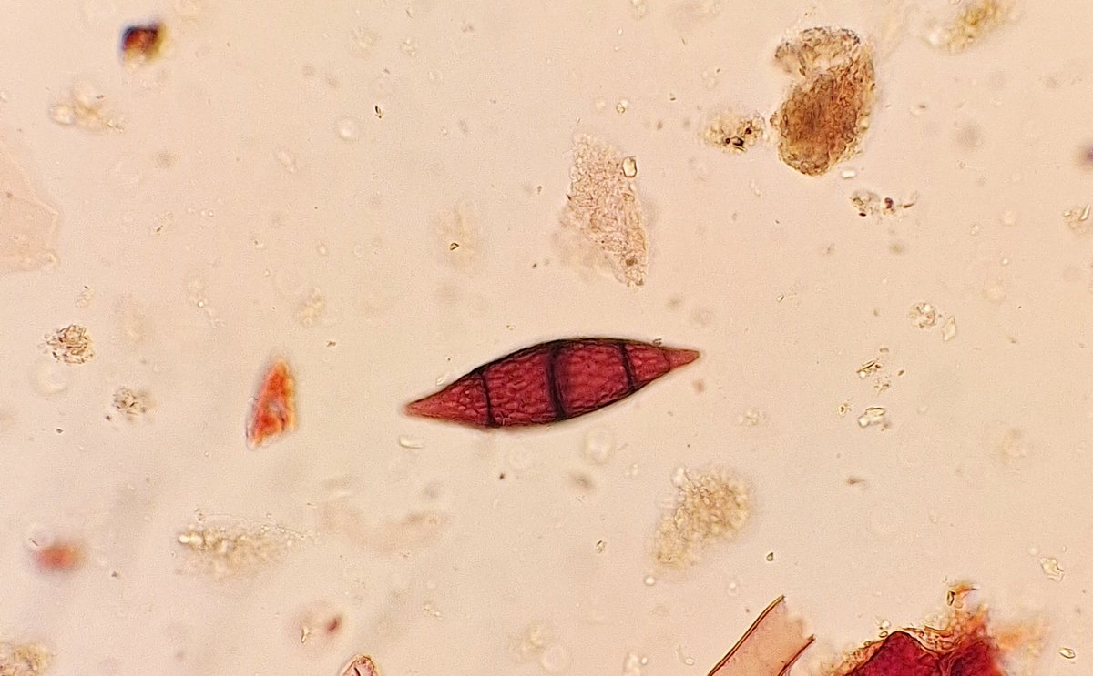 Dr Marta PerezFernandez (@martaperfer) on Twitter photo Hello. Please, I need help identifying this spore. I have seen it before but I can't find the reference.  It was found in a sample from an Early Holocene UK. #pollen and spores Hello. Please, I need help identifying this spore. I have seen it before but I can't find the reference.  It was found in a sample from an Early Holocene UK. #pollen and spores