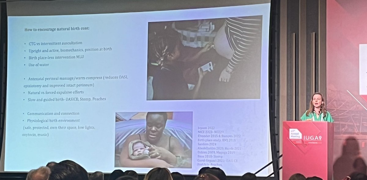 Katherine Clark (@renalmidwife) on Twitter photo Great talk from <a href="/li22ieP/">Lizzie Phillips</a> sharing the evidence around birth choices, keeping women/birthing people at the centre and the importance of having the #midwife voice at the table when discussing perineal and pelvic floor health #IUGA2024 <a href="/iugaoffice/">International Urogynecological Association (IUGA)</a> Great talk from <a href="/li22ieP/">Lizzie Phillips</a> sharing the evidence around birth choices, keeping women/birthing people at the centre and the importance of having the #midwife voice at the table when discussing perineal and pelvic floor health #IUGA2024 <a href="/iugaoffice/">International Urogynecological Association (IUGA)</a>