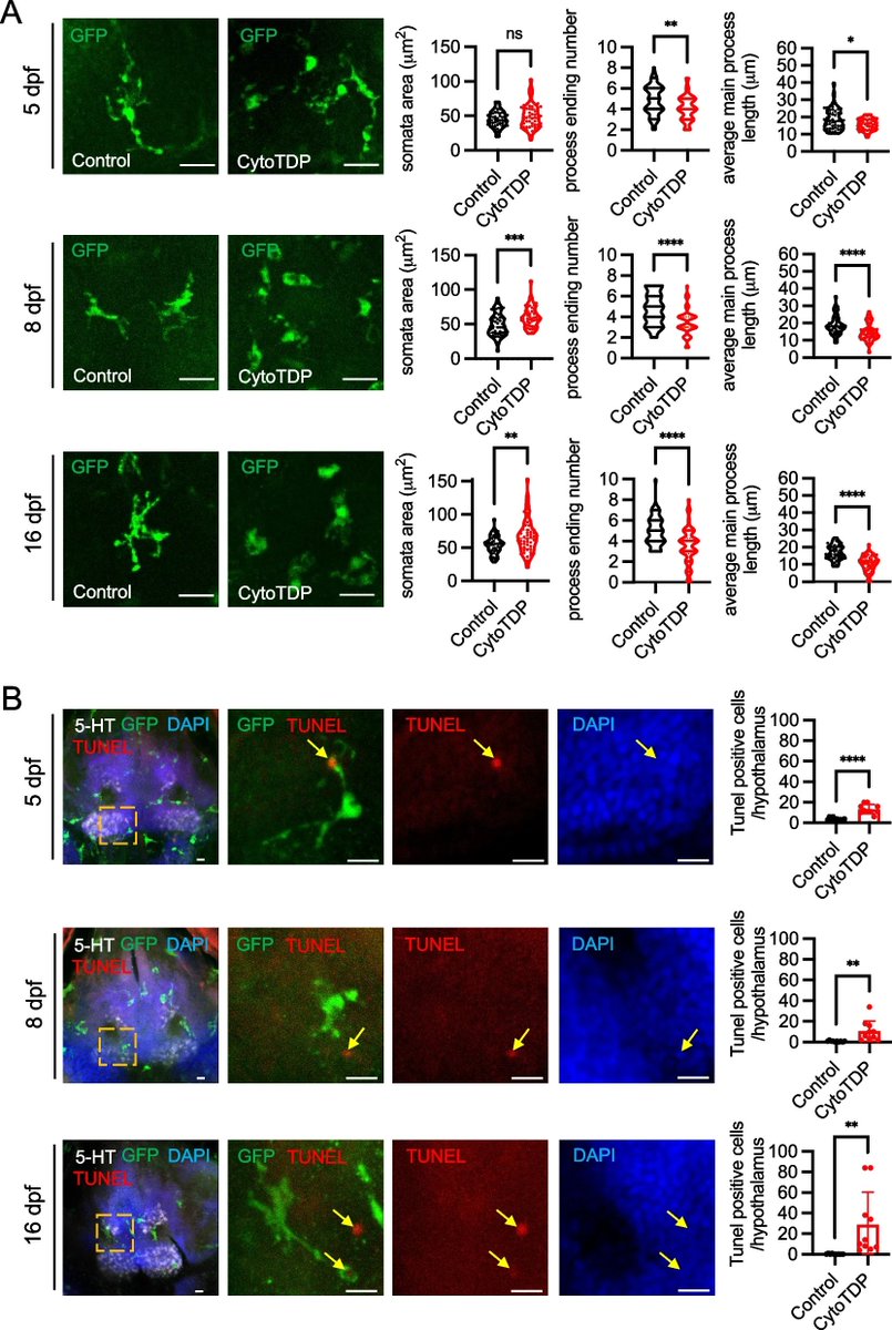 Molecular Neurodegeneration (@molneuro) on Twitter photo 'Mis-localization of endogenous #TDP43 leads to #ALS-like early-stage metabolic dysfunction and progressive motor deficits'
Yiying Hu, Alexander Hruscha, Chenchen Pan...Bettina Schmid @DZNE_en @SyNergy_Cluster
bit.ly/45vRfEk 'Mis-localization of endogenous #TDP43 leads to #ALS-like early-stage metabolic dysfunction and progressive motor deficits'
Yiying Hu, Alexander Hruscha, Chenchen Pan...Bettina Schmid @DZNE_en @SyNergy_Cluster
bit.ly/45vRfEk