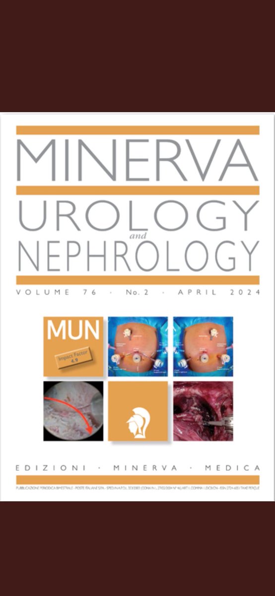 Minerva Urology and Nephrology (@mun_journal) on Twitter photo Celebrating 2023 Impact Factor. 4.9!!📈 🎉🎉
Thanks to the great efforts of all the authors, reviewers, and the editorial board for ensuring this success!!
<a href="/PorpigliaF/">Porpiglia Francesco</a> <a href="/bernardorocco73/">Bernardo Rocco, MD,FRCS (Glasgow)</a> <a href="/cosimodenunzio/">Cosimo De Nunzio</a> <a href="/ricautor/">Riccardo Autorino MD PhD FACS</a> <a href="/foxal72/">Alessandro Volpe</a> <a href="/evanliats/">EVANGELOS LIATSIKOS</a> <a href="/homizargar/">Assoc Professor Homi Zargar</a> <a href="/AlessandroCres/">Alessandro Crestani</a> <a href="/fraesperto/">Francesco Esperto</a> Celebrating 2023 Impact Factor. 4.9!!📈 🎉🎉
Thanks to the great efforts of all the authors, reviewers, and the editorial board for ensuring this success!!
<a href="/PorpigliaF/">Porpiglia Francesco</a> <a href="/bernardorocco73/">Bernardo Rocco, MD,FRCS (Glasgow)</a> <a href="/cosimodenunzio/">Cosimo De Nunzio</a> <a href="/ricautor/">Riccardo Autorino MD PhD FACS</a> <a href="/foxal72/">Alessandro Volpe</a> <a href="/evanliats/">EVANGELOS LIATSIKOS</a> <a href="/homizargar/">Assoc Professor Homi Zargar</a> <a href="/AlessandroCres/">Alessandro Crestani</a> <a href="/fraesperto/">Francesco Esperto</a>