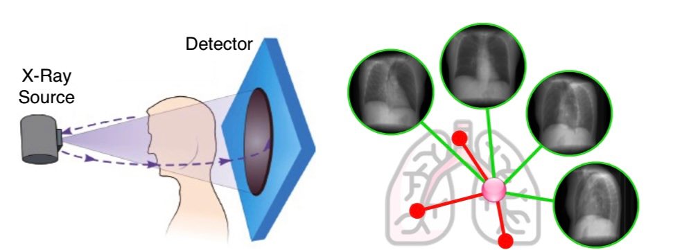 Interested in how <a href="/CVPR/">#CVPR2025</a> can contribute to healthcare? 

Stop by X-Med posters at #CVPR2024 today from 10:30 am - 12:30 pm in Arch 4A-E.

Check out posters #150 and #191 to learn about the latest applications of computer vision in medical scenarios 🩻.

#CVPR2024 #HealthcareTech