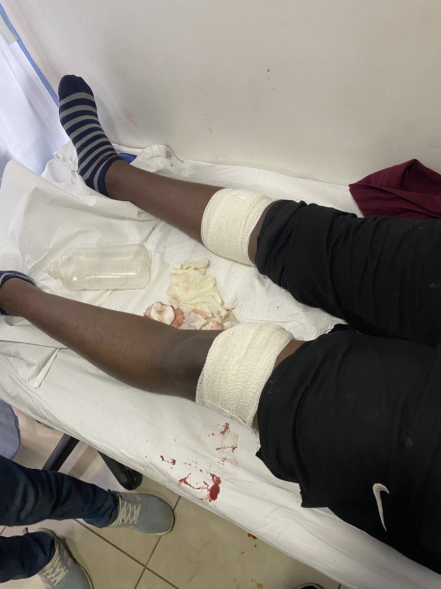 Anto_mbuguaa's tweet photo. Wameshoot my pal miguu…..fuck this goververment….. they’re using live bullets….
#rejectfinancebill2024 https://t.co/SXwVJTOPd1