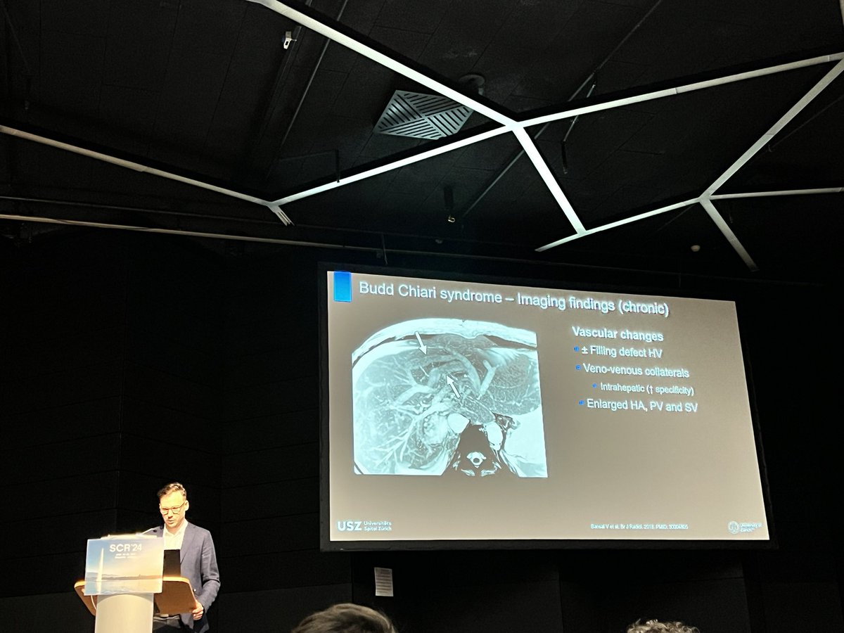 Soleen Stocker-Ghafoor (@sghafoormd) on Twitter photo ๐ Nice didactic talk on imaging findings in vascular and inflammatory liver diseases by <a href="/danielstockerMD/">Daniel Stocker</a> at the โ24 Swiss Congress of Radiology <a href="/RadiologieUSZ/">Radiologie USZ</a> <a href="/info_scr/">Swiss Congress of Radiology</a> ๐ Nice didactic talk on imaging findings in vascular and inflammatory liver diseases by <a href="/danielstockerMD/">Daniel Stocker</a> at the โ24 Swiss Congress of Radiology <a href="/RadiologieUSZ/">Radiologie USZ</a> <a href="/info_scr/">Swiss Congress of Radiology</a>