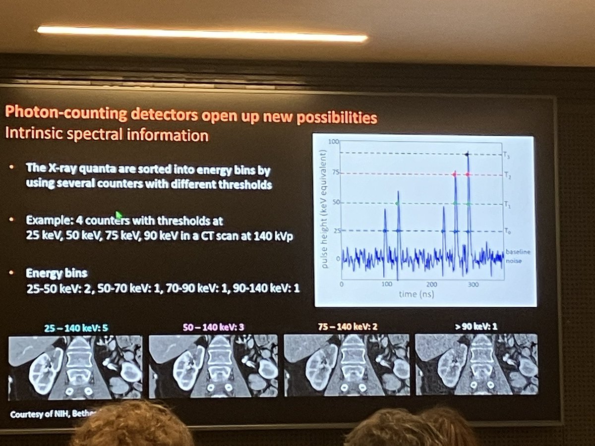 Alkadhi (@alkadhi_rad) on Twitter photo The brain (Prof. Flohr <a href="/SiemensHealth/">Siemens Healthineers</a>) behind the technology (#photoncounting #CT) explains it to users (#radiologists)
Now live <a href="/info_scr/">Swiss Congress of Radiology</a> in #geneva
<a href="/MatthEberhard/">Matthias Eberhard</a> <a href="/euler_andre/">Andre Euler MD</a> <a href="/RadiologieUSZ/">Radiologie USZ</a> The brain (Prof. Flohr <a href="/SiemensHealth/">Siemens Healthineers</a>) behind the technology (#photoncounting #CT) explains it to users (#radiologists)
Now live <a href="/info_scr/">Swiss Congress of Radiology</a> in #geneva
<a href="/MatthEberhard/">Matthias Eberhard</a> <a href="/euler_andre/">Andre Euler MD</a> <a href="/RadiologieUSZ/">Radiologie USZ</a>