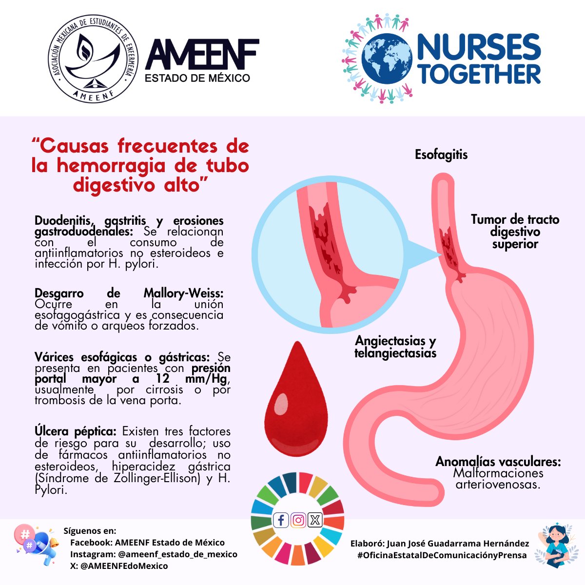 AMEENFEdoMexico's tweet photo. 🩸 Causas frecuentes de la hemorragia de tubo digestivo alto

#OficinaEstatalDeComunicaciónyPrensa

📱💻Síguenos en:
🌐 Facebook: https://t.co/iBbOyASlG8
🌐 Instagram: https://t.co/2NJiZnIh35
🌐 X: https://t.co/KVqHFT7Pca https://t.co/cBNO8KI68u