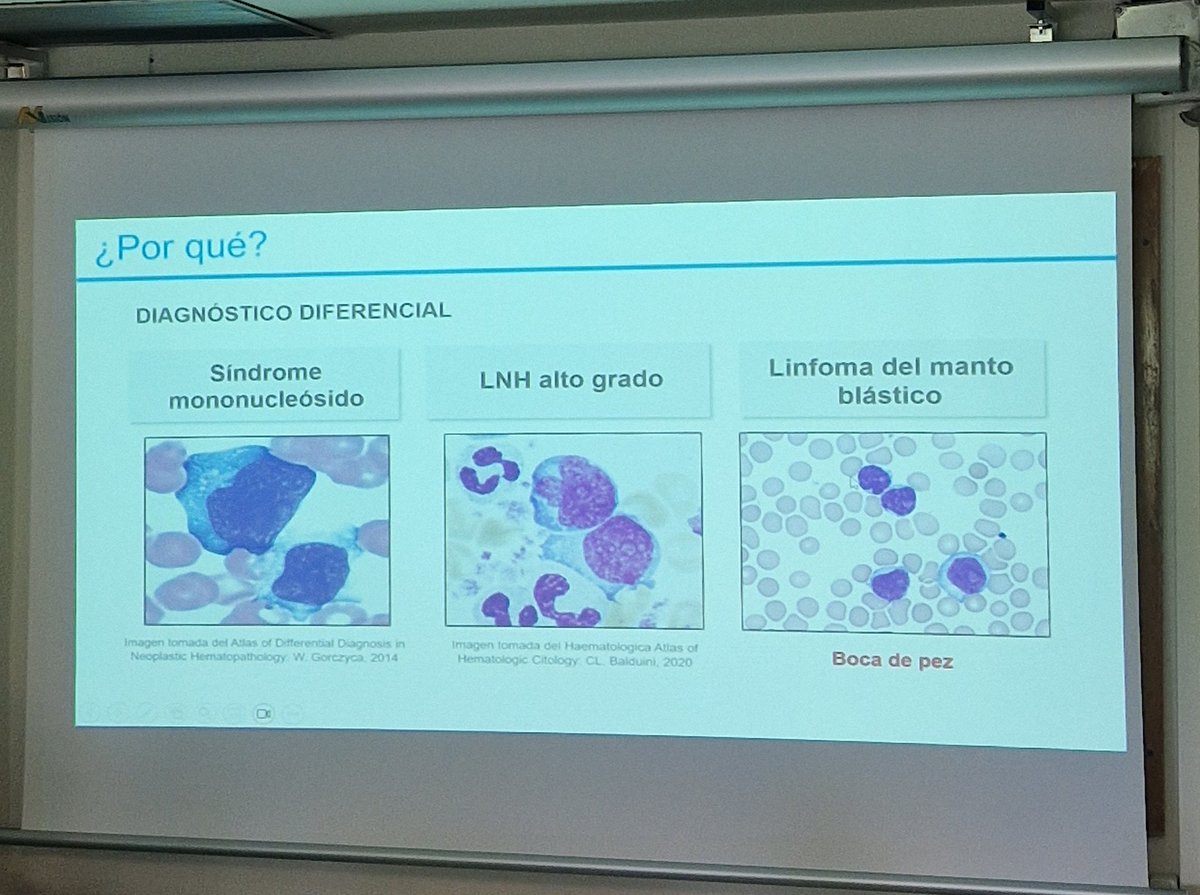 mer_501's tweet photo. Alarma de blastos y manejo de leucemias agudas en la urgencia, gracias @Irene_sanchezv y @anamendozm por el enfoque tan útil y práctico!
#hematobites
@HematoLaPaz https://t.co/HWbYNYKrJ9