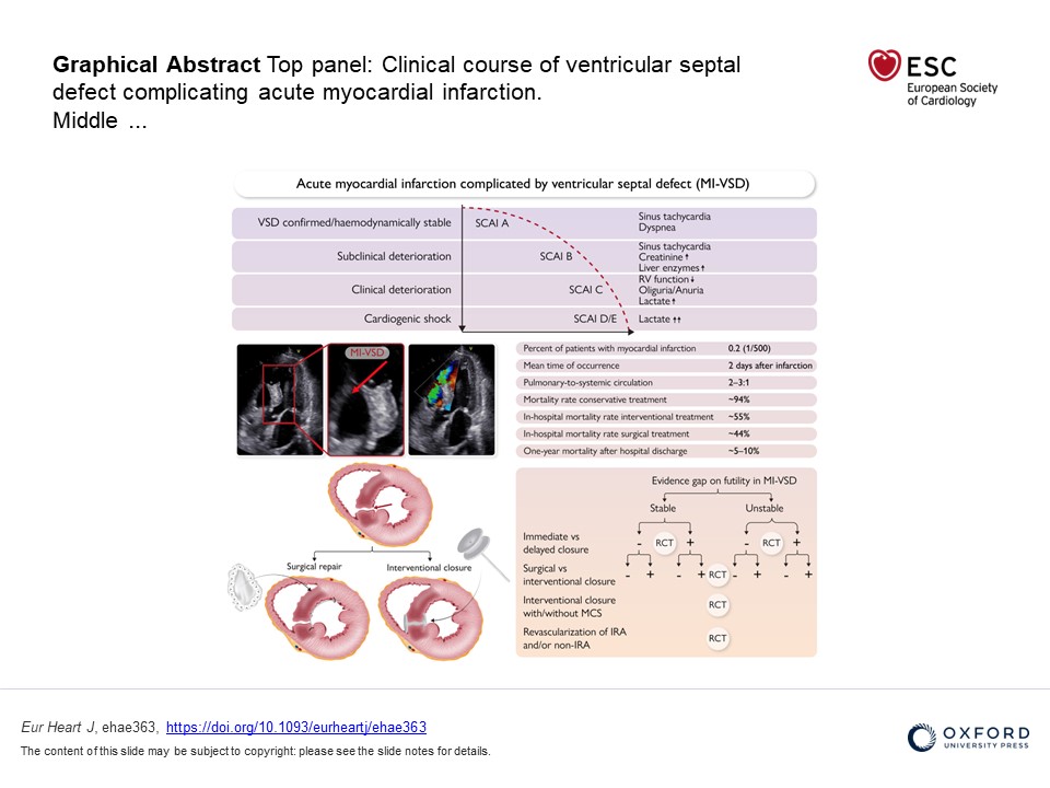 EHJ Editor-in-Chief (@ehj_ed) on Twitter photo Ventricular septal defect complicating acute MI: diagnosis and management. A Clinical Consensus Statement of the ACVC of the ESC, the EAPC of the ESC and the ESC Working Group on Cardiovascular Surgery, just published in EHJ.
doi.org/10.1093/eurhea…
#VSD <a href="/ESC_Journals/">European Society of Cardiology Journals</a> Ventricular septal defect complicating acute MI: diagnosis and management. A Clinical Consensus Statement of the ACVC of the ESC, the EAPC of the ESC and the ESC Working Group on Cardiovascular Surgery, just published in EHJ.
doi.org/10.1093/eurhea…
#VSD <a href="/ESC_Journals/">European Society of Cardiology Journals</a>
