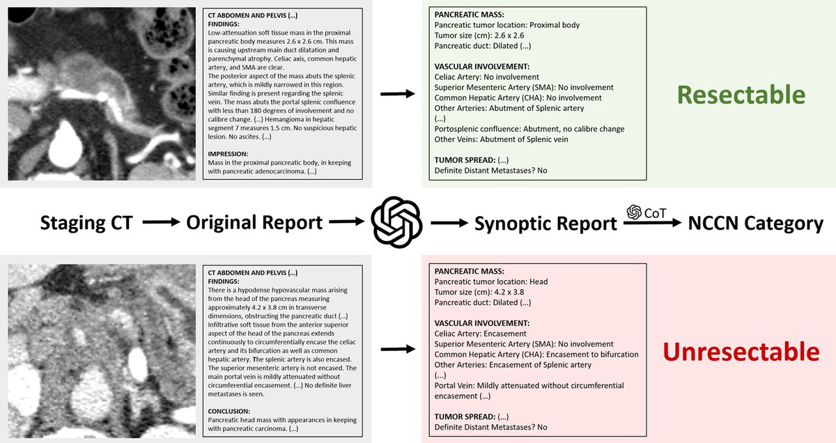 GPT-4 enabled near-perfect creation of pancreatic ductal adenocarcinoma synoptic reports from original reports and accurate resectability categorization using chain-of-thought prompting. <a href="/imagingtoronto/">University Medical Imaging Toronto (UMIT)</a> <a href="/RajeshBhayana_/">Rajesh Bhayana</a> <a href="/SatheeshToronto/">Satheesh Krishna</a> bit.ly/4cqQ8I2