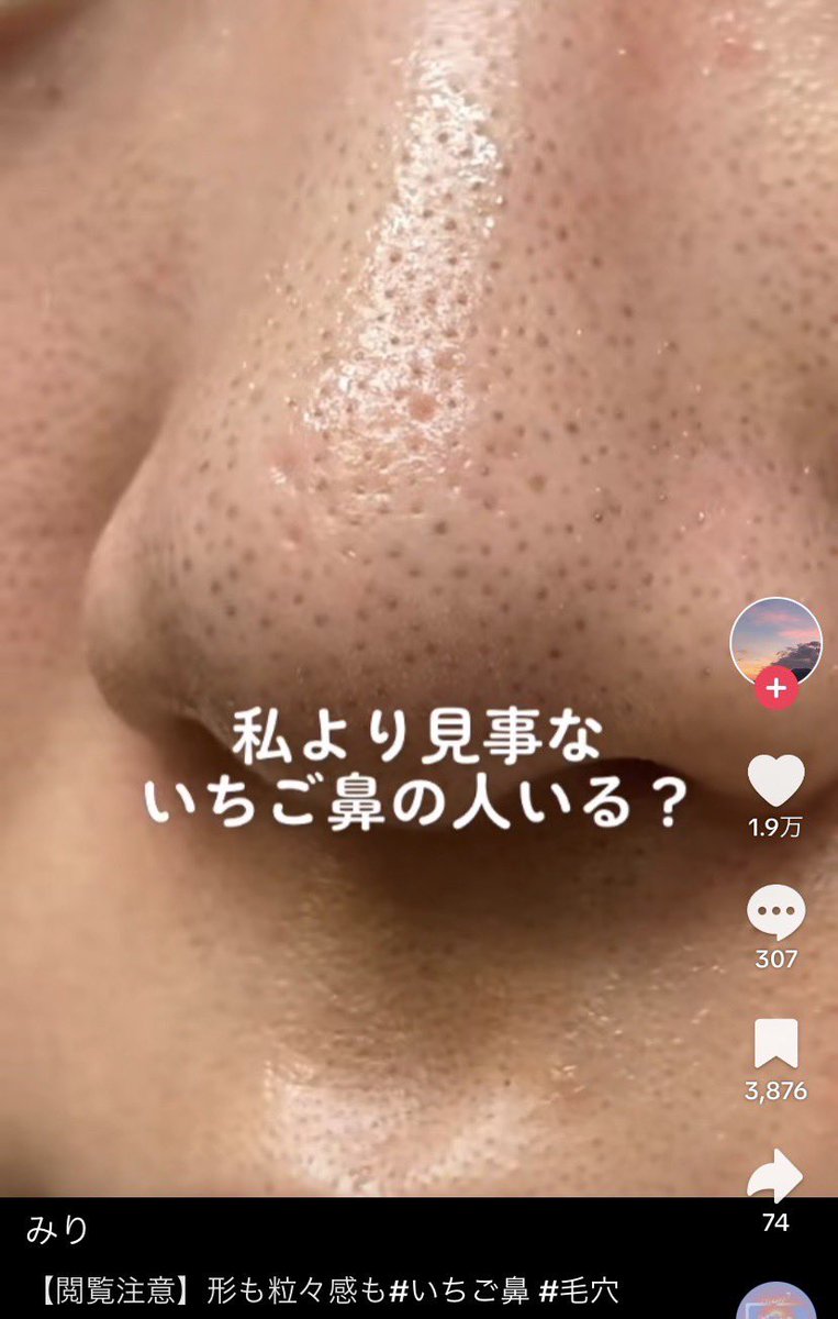 𝙮𝙪𝙢𝙚𝙥𝙥𝙞 tweet media