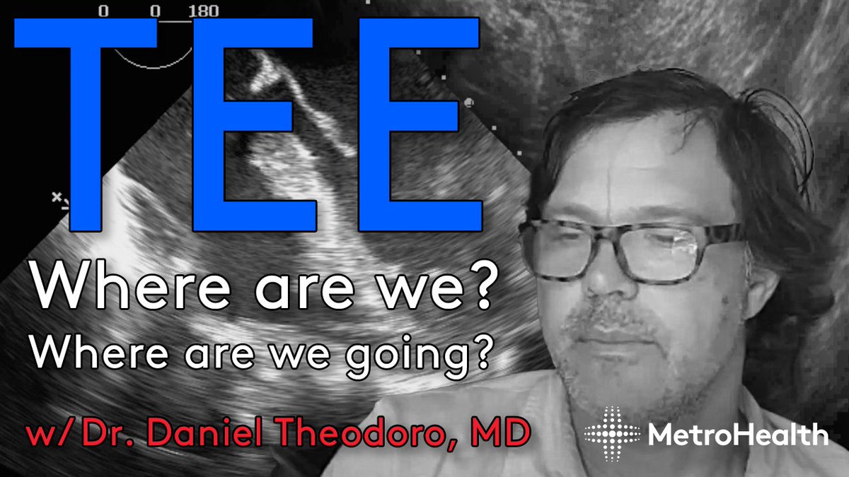 MetroHealth Emergency Ultrasound (@mh_emultrasound) on Twitter photo Last week at Grand Rounds <a href="/TeddyDanielz/">Daniel Theodoro MD MSCI</a> gave an amazing lecture by TEE and ultrasound in resuscitation science. Check out the video here.
youtu.be/WyMcWk0QHM8
#MetroEUS #POCUS #Ultrasound #echofirst Last week at Grand Rounds <a href="/TeddyDanielz/">Daniel Theodoro MD MSCI</a> gave an amazing lecture by TEE and ultrasound in resuscitation science. Check out the video here.
youtu.be/WyMcWk0QHM8
#MetroEUS #POCUS #Ultrasound #echofirst