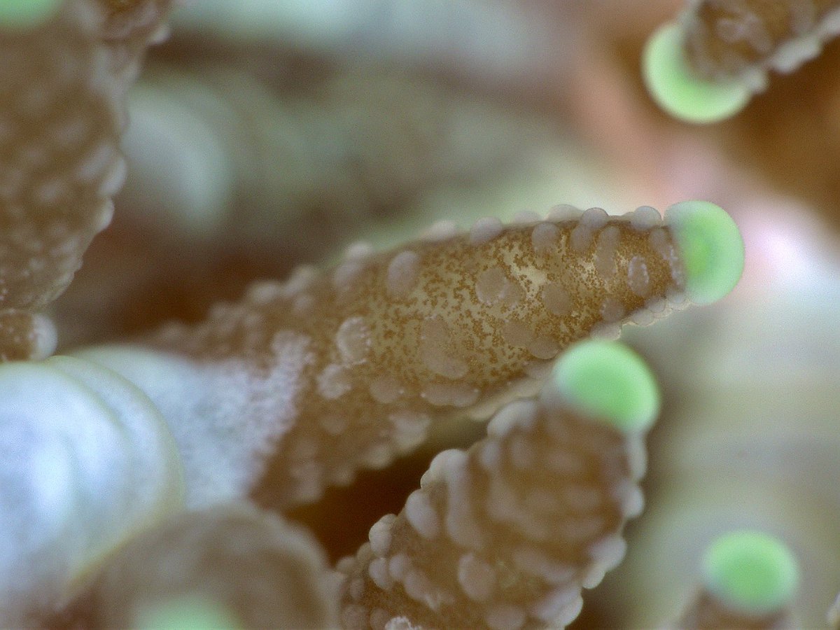 Look at those lil freckles! Its so cool that we are able to see coral symbionts so clearly with our new microscope :)