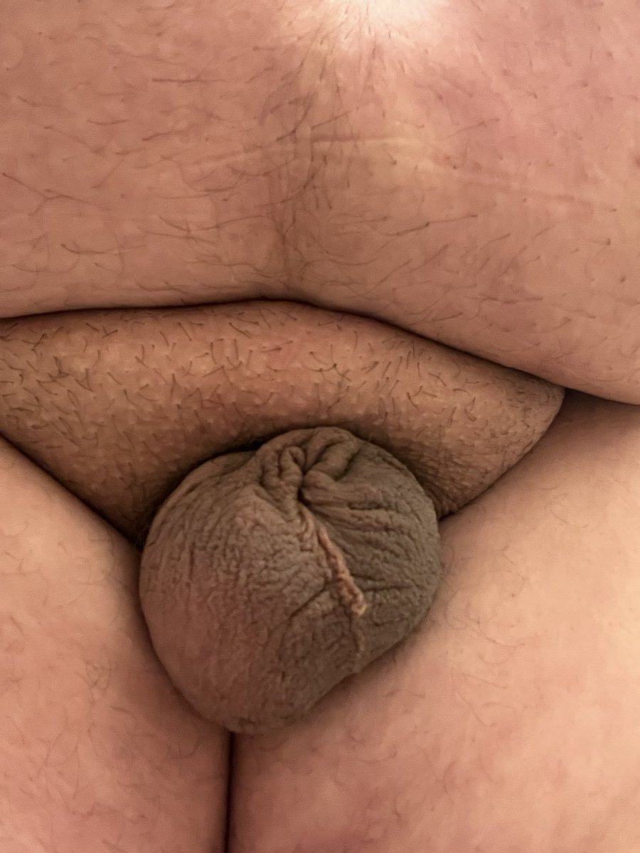 Exposed MicroDick tweet media