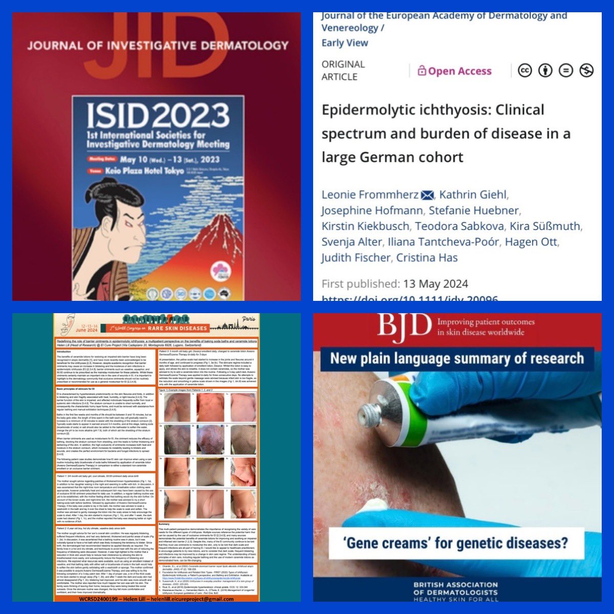 EI_cure_project's tweet image. In the coming days I would like to share all that we have achieved in our first year!🏆

I’d like to share how much our capacity for RESEARCH has grown…

Please donate to fund research:
eicureproject.com/donate

Thank you🥰

#eicureproject #findacure #geneediting #WCRSD #RareDERM