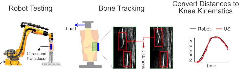 Matthew Blomquist (@mb_blomquist) on Twitter photo Our study “Ultrasound-based bone tracking using cross-correlation enables dynamic measurements of knee kinematics during clinical assessments” was just published open-access in <a href="/JEO_journal/">JEO - Journal of Experimental Orthopaedics</a>! bit.ly/3zclLH9
A 🧵 1/6
<a href="/UW_BAMLab/">Roth Group: Biomechanical Advances in Medicine Lab</a> <a href="/UWMadison_BME/">UW-Madison BME</a> <a href="/wiscorthopedics/">UW Orthopedics and Rehabilitation</a> <a href="/JDRothPhD/">Joshua D Roth</a> Our study “Ultrasound-based bone tracking using cross-correlation enables dynamic measurements of knee kinematics during clinical assessments” was just published open-access in <a href="/JEO_journal/">JEO - Journal of Experimental Orthopaedics</a>! bit.ly/3zclLH9
A 🧵 1/6
<a href="/UW_BAMLab/">Roth Group: Biomechanical Advances in Medicine Lab</a> <a href="/UWMadison_BME/">UW-Madison BME</a> <a href="/wiscorthopedics/">UW Orthopedics and Rehabilitation</a> <a href="/JDRothPhD/">Joshua D Roth</a>