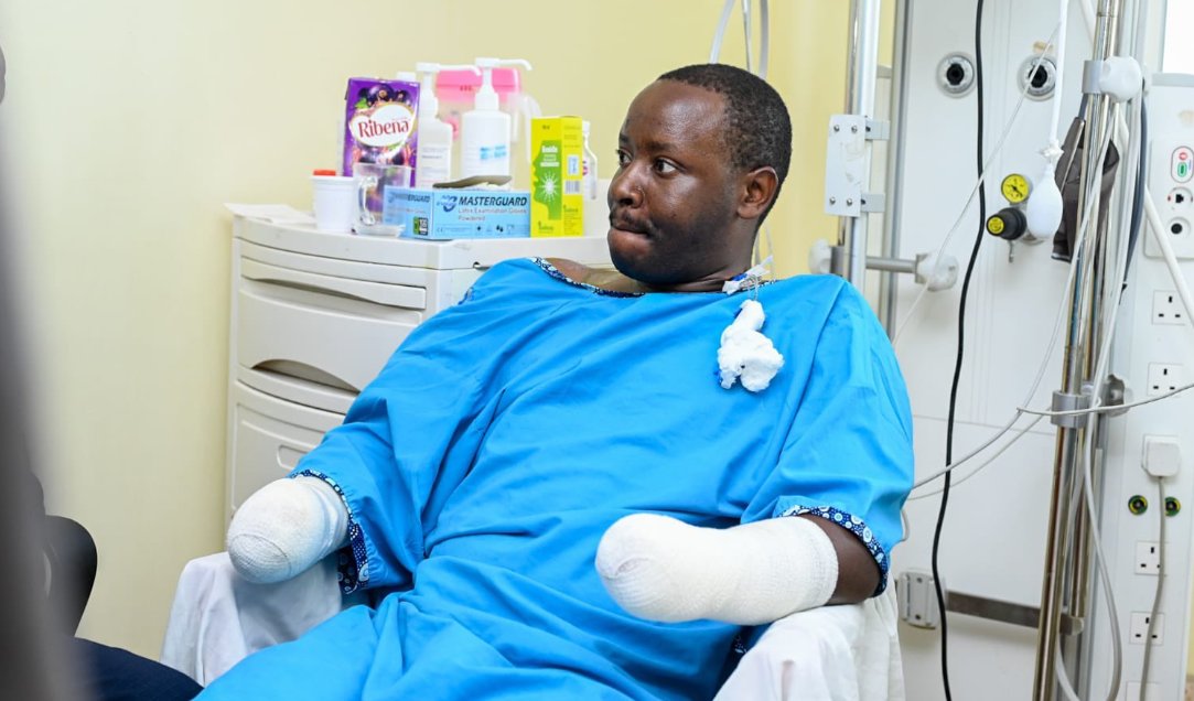 ‘I don’t know what I will tell my kids’ – Chief Inspector who lost arms in protest speaks tinyurl.com/4wymv7y7