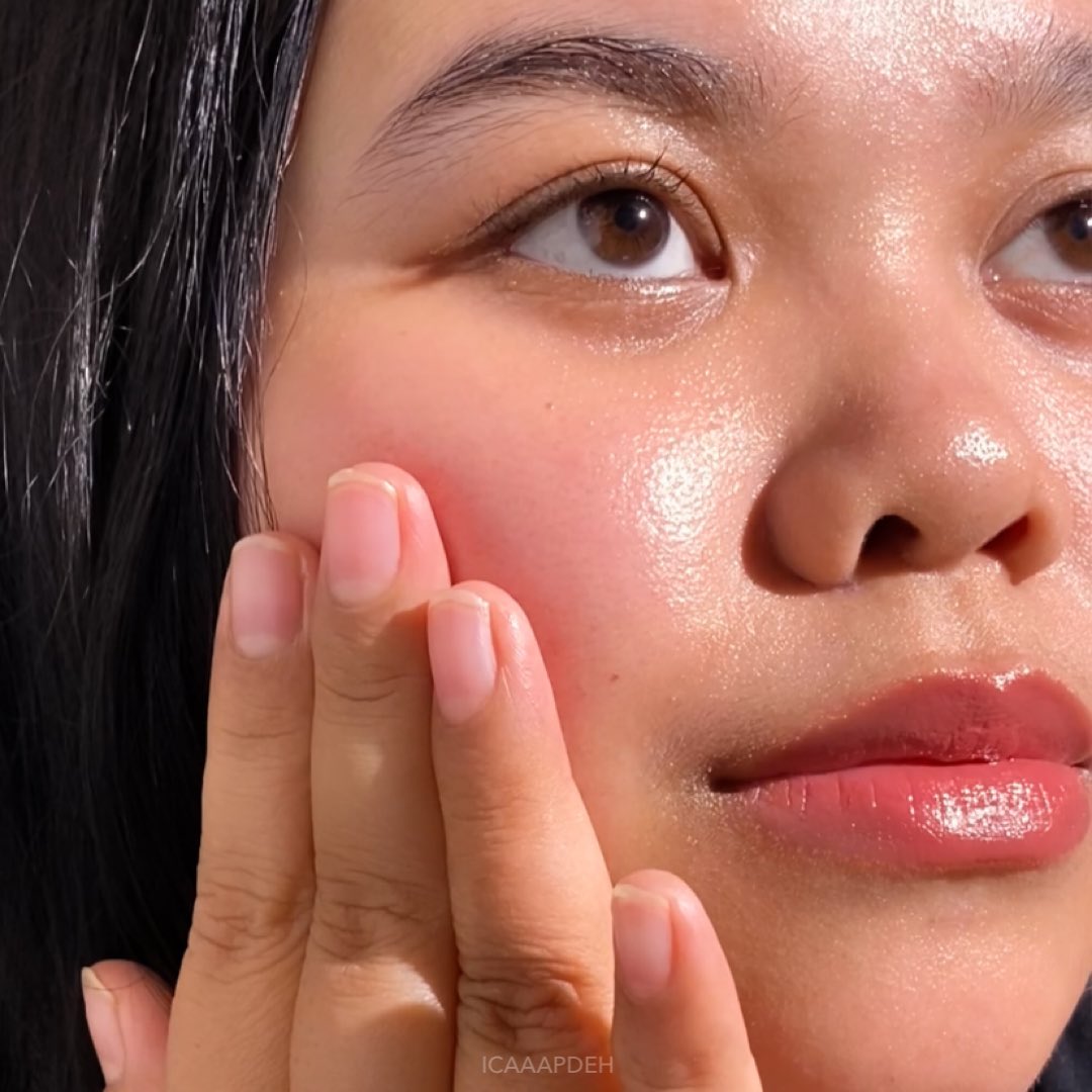 icaaapdeh's tweet photo. #ReviewnyaIca [❤️+🔁] Demi apasih ini moisturizer superrr ringan yang pernah aku pake! Jangan diskip, pantengin sampe abis yaaa😭🫵🏻 

Asli dehhh liat ini kulitku after pake moisturizernya auto plumpy, hydrate &amp; glowing dongg OMG suka bgttt🥹 

#racuninskincare https://t.co/KiHPFULtRd