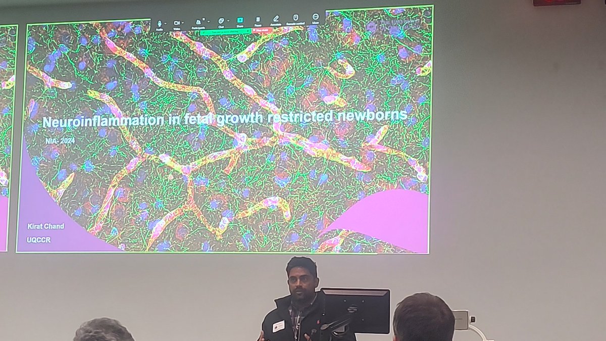 Aakanksha Dixit (@vatsedixit_aaks) on Twitter photo Our very own <a href="/ChandKirat/">Kirat Chand</a> presenting data about use of stem cells in fetal growth restricted babies study model. <a href="/NeuroimmOZ/">Neuroimmunology Australia</a> #UQCCR <a href="/uqnews/">uqnews</a> Our very own <a href="/ChandKirat/">Kirat Chand</a> presenting data about use of stem cells in fetal growth restricted babies study model. <a href="/NeuroimmOZ/">Neuroimmunology Australia</a> #UQCCR <a href="/uqnews/">uqnews</a>