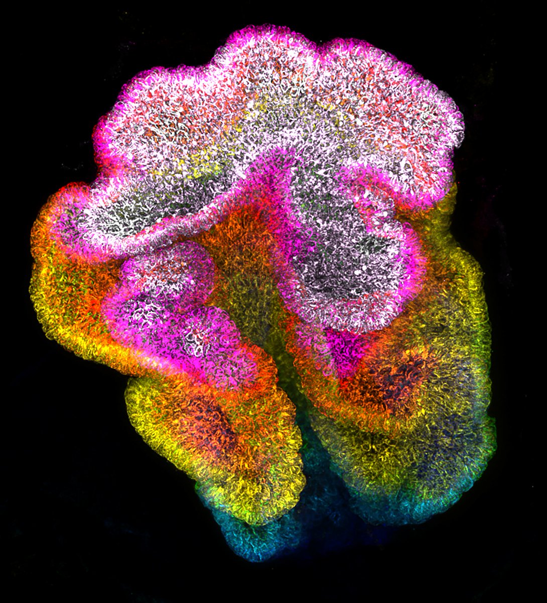 A flower in the brain (The choroid plexus, CSF producing tissue, in the zebrafish brain). #FluorescenceFriday #zebrafish If you want to know about it, please check our paper doi.org/10.1016/j.celr… and visit my poster (PS07-29AM-327) 29th Jun at #FENS2024
