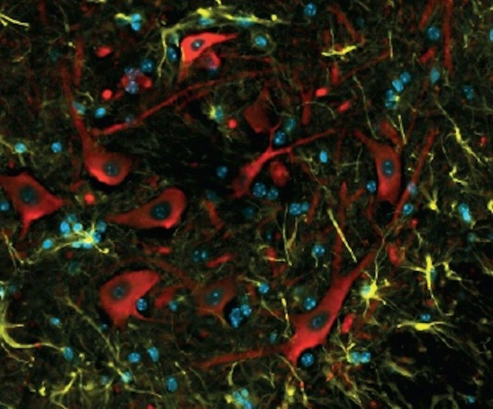 UK Dementia Research Institute (@ukdri) on Twitter photo This year, research by <a href="/adrianisaacslab/">Adrian Isaacs Lab</a> revealed insight into early changes that occur in the brains of people with ALS. Using a mouse model, the team unexpectedly uncovered a protective response in neurons that could be harnessed for new treatments 👉buff.ly/3V5EZHc
2/6 This year, research by <a href="/adrianisaacslab/">Adrian Isaacs Lab</a> revealed insight into early changes that occur in the brains of people with ALS. Using a mouse model, the team unexpectedly uncovered a protective response in neurons that could be harnessed for new treatments 👉buff.ly/3V5EZHc
2/6