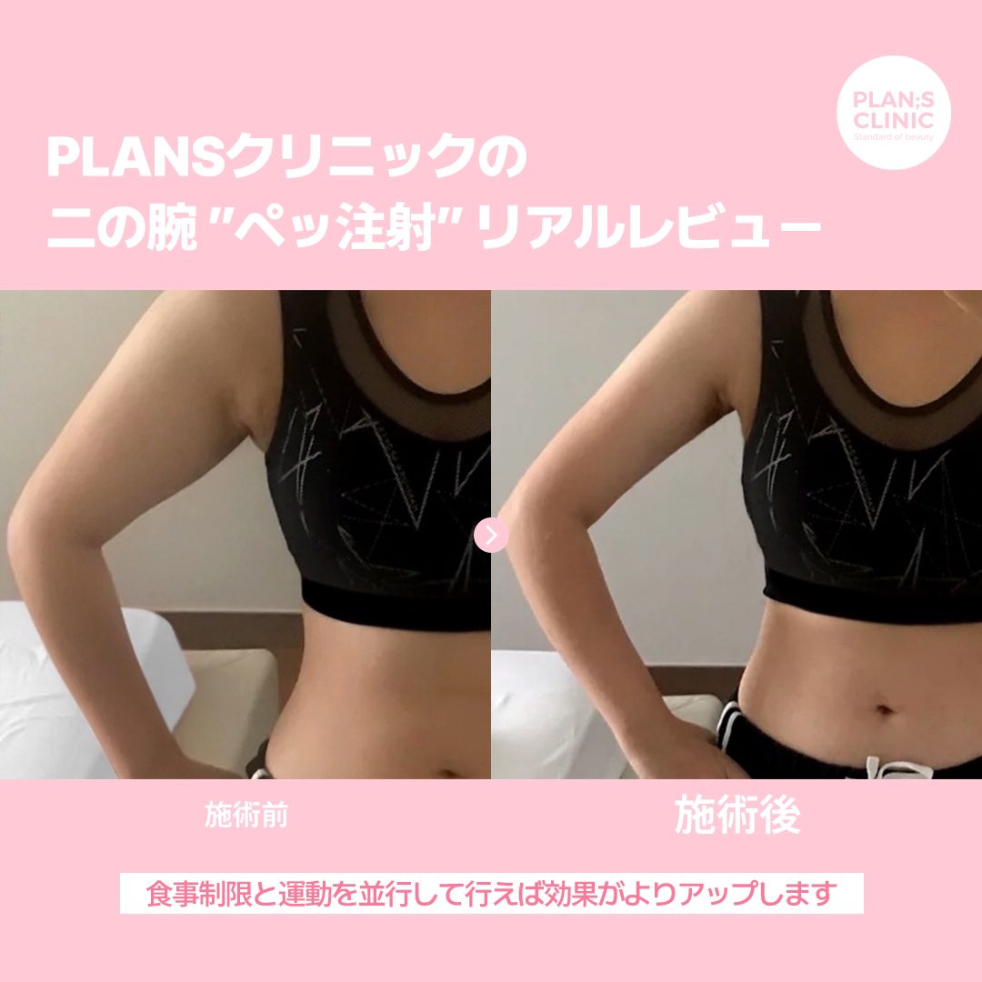 プランエス　脂肪 sddefault.jpg