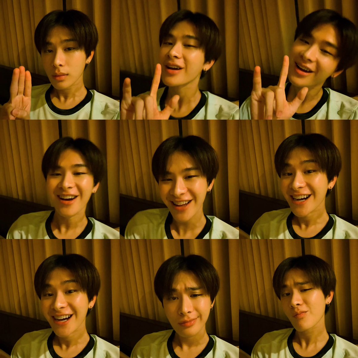 ตี๋ ขี้เล่น หนุ่มหล่อน่าใส ใส่รีเทนเนอร์หนิㅠㅠ