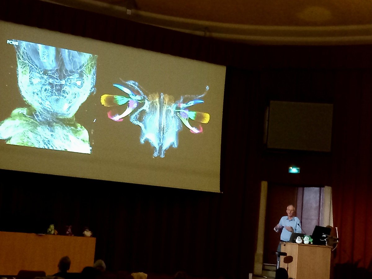 De magnfiques images du programme HuDeCA ! Merci à Alain Chedotal pour cette véritable  immersion dans le développement embryonnaire !!