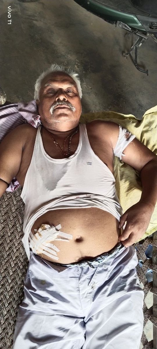 mlaShubhamgupta's tweet image. @sultanpurpolice @myogiadityanath 
आज-कल Police इतना भ्रष्ट हो गयी है बिना पैसे के कोई काम भी नहीं करती.मेरे नाना जी सो रहे थे,को कुल्हाड़ी से मारने का प्रयास किया गया. पुलिस विपक्षी से पैसे लेकर जो धारा लगना चाहिए usko badlwa diya.आम आदमी सुरक्षित नहीं
#ShameonAkhandnagarpoli