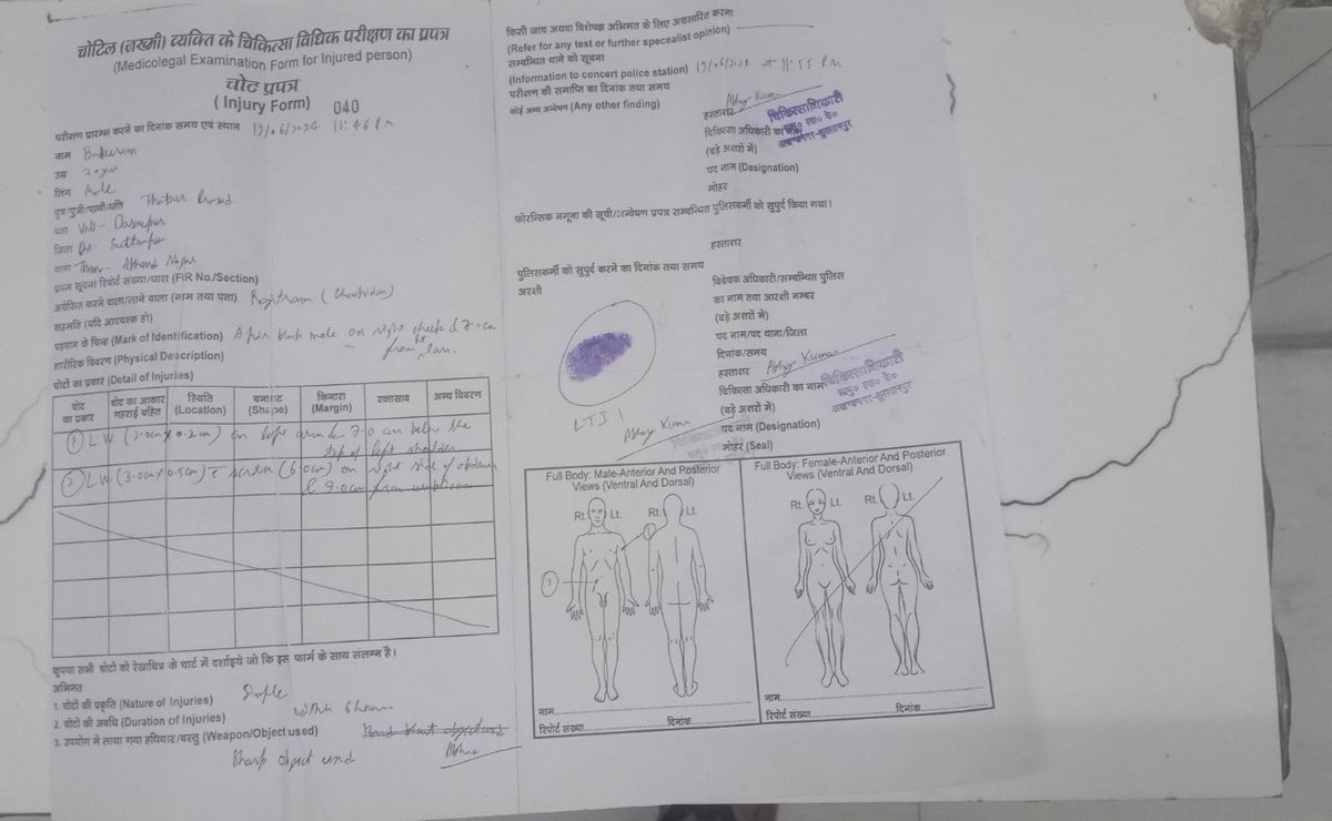 mlaShubhamgupta's tweet image. @sultanpurpolice @myogiadityanath 
आज-कल Police इतना भ्रष्ट हो गयी है बिना पैसे के कोई काम भी नहीं करती.मेरे नाना जी सो रहे थे,को कुल्हाड़ी से मारने का प्रयास किया गया. पुलिस विपक्षी से पैसे लेकर जो धारा लगना चाहिए usko badlwa diya.आम आदमी सुरक्षित नहीं
#ShameonAkhandnagarpoli