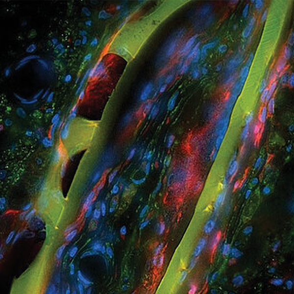 A new generation of neural interfaces replaces metals with engineered graphene, making electrodes smaller yet just as effective! 

The EGNITE device promises selective nerve activation for neuroprosthetics @CIBERNED @xaviernavarro8 

Find out more: ow.ly/Hr7050Sn36j