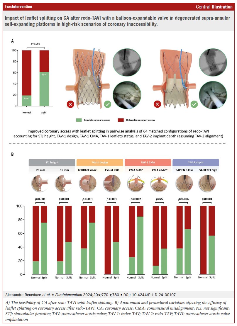 This study showed that leaflet splitting can improve coronary access during redo-TAVI, particularly in cases where degenerated valves pose a high risk of coronary access impairment. Read more 
ow.ly/vpkL50Sn4Yf
Editorial: shorturl.at/KqsHL